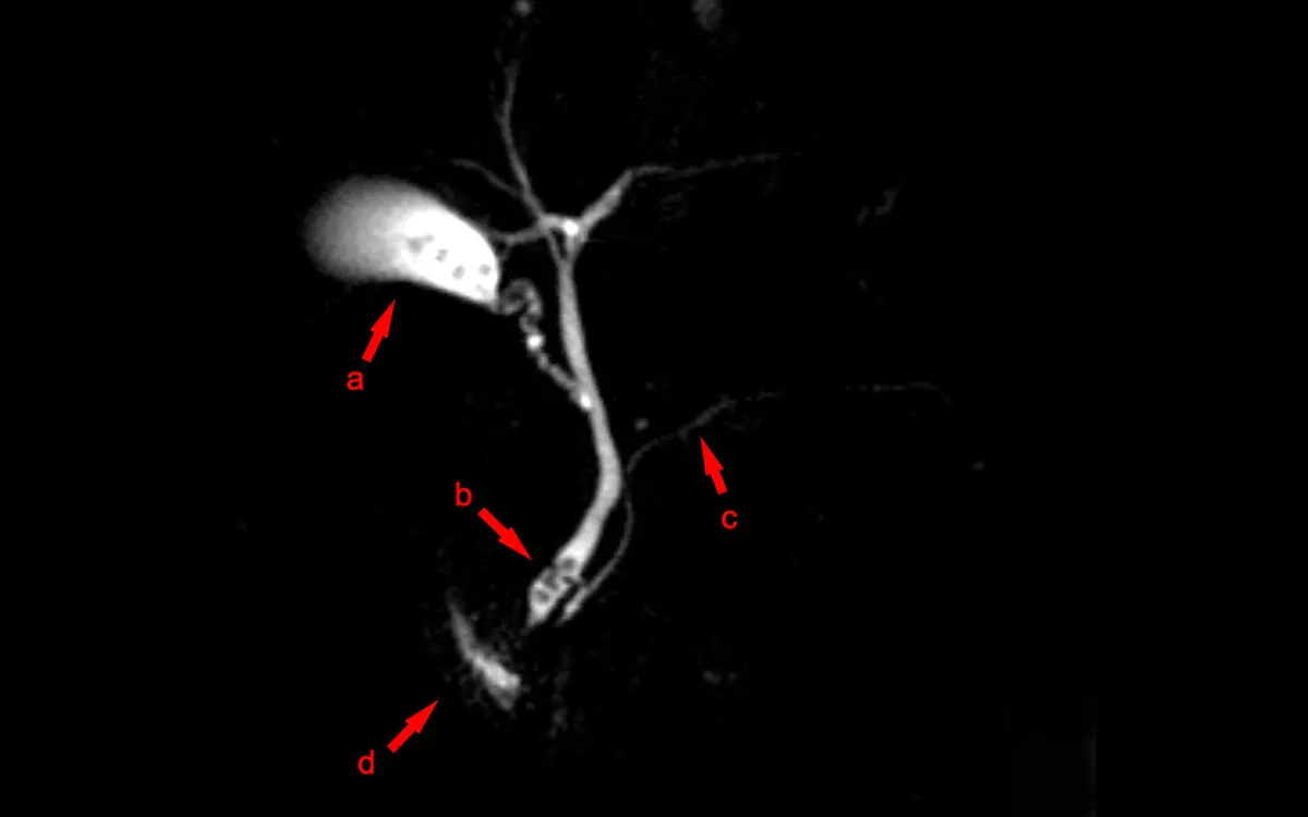Abdomen and Pelvic MRI Second Opinion