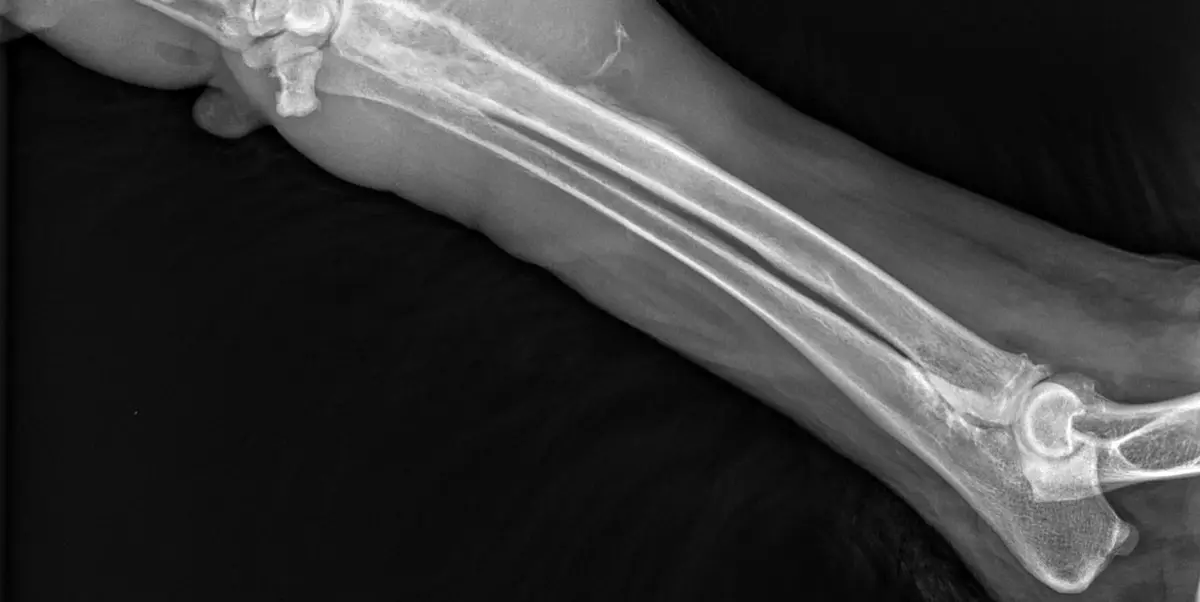 Köpekte kemik tümörü aramak için kullanılan türden, ön bacak uzun kemiklerini gösteren röntgen görüntüsü