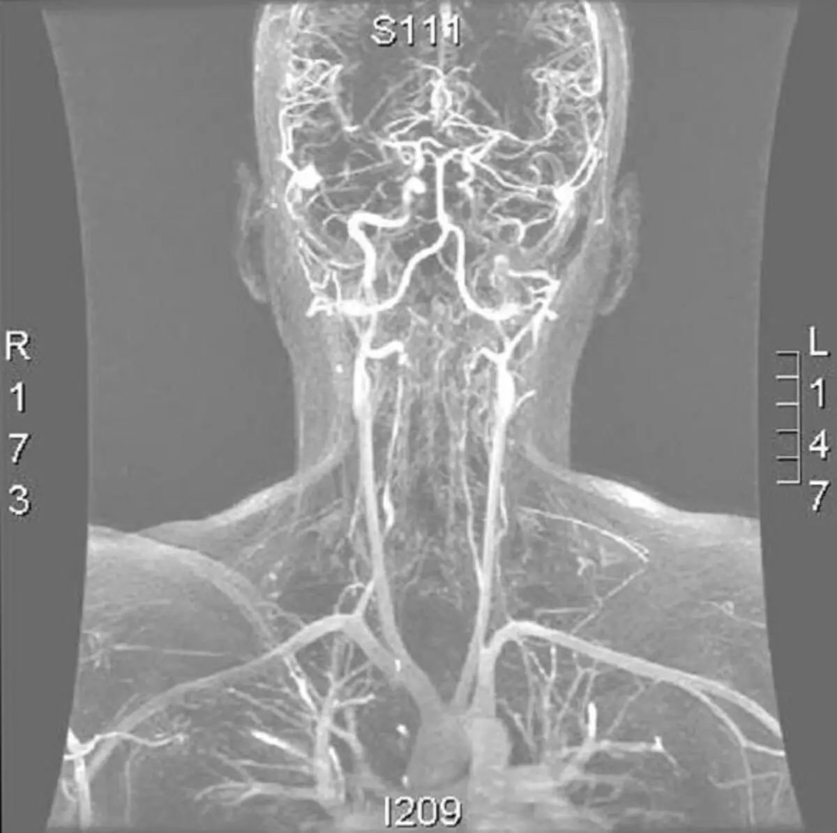 Is MRI Contrast Safe?