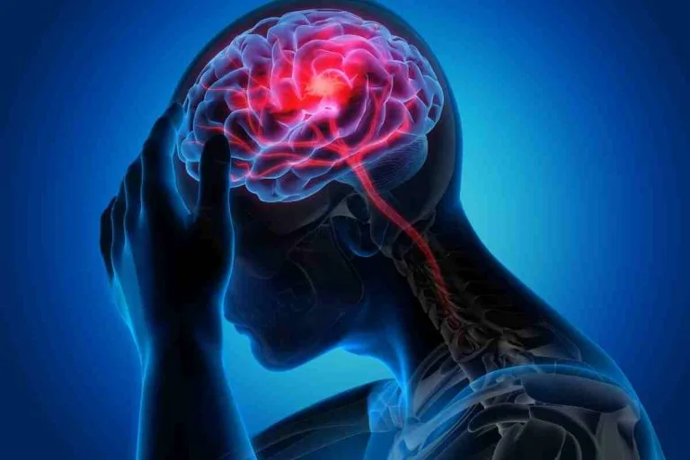 Why a Second Opinion in Neurology Matters: When and How to Seek One