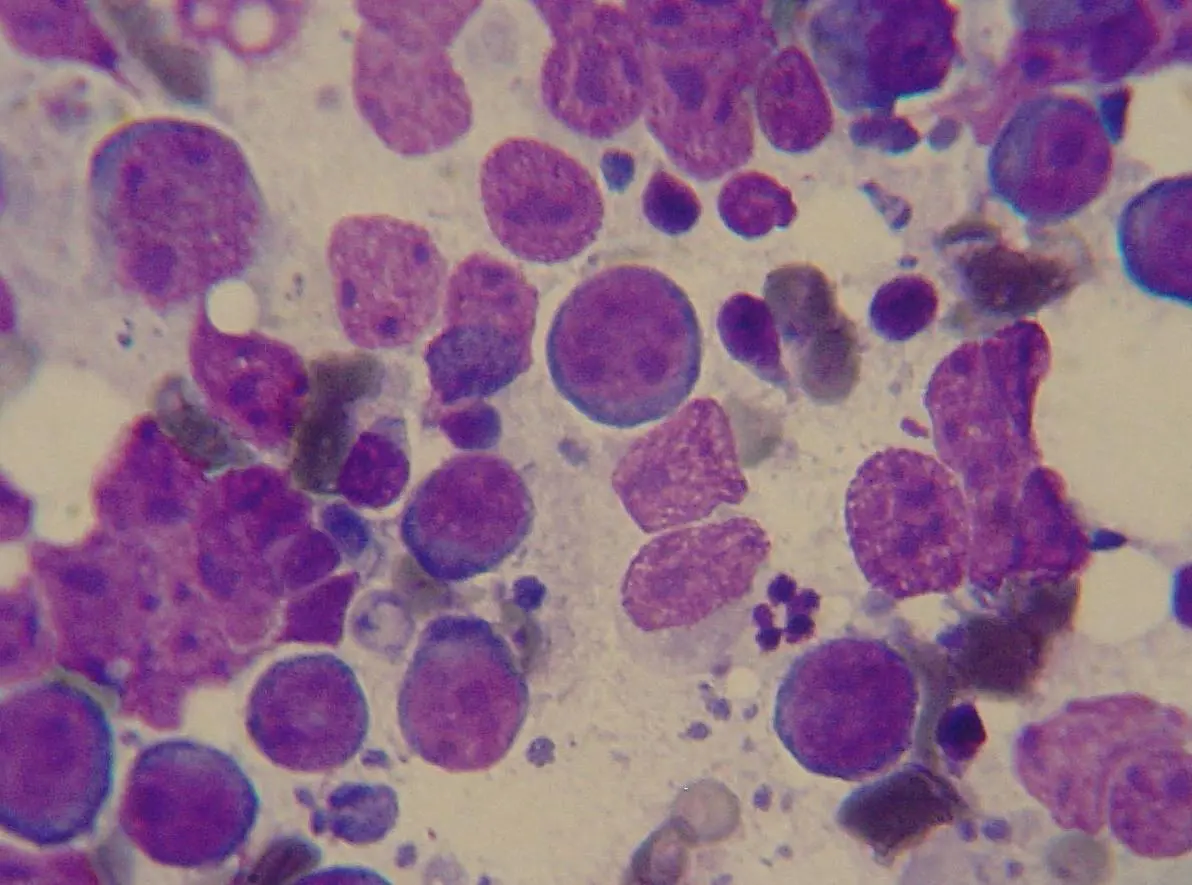 Lymphoma in Dogs: What Enlarged Lymph Nodes and Staging Scans Show