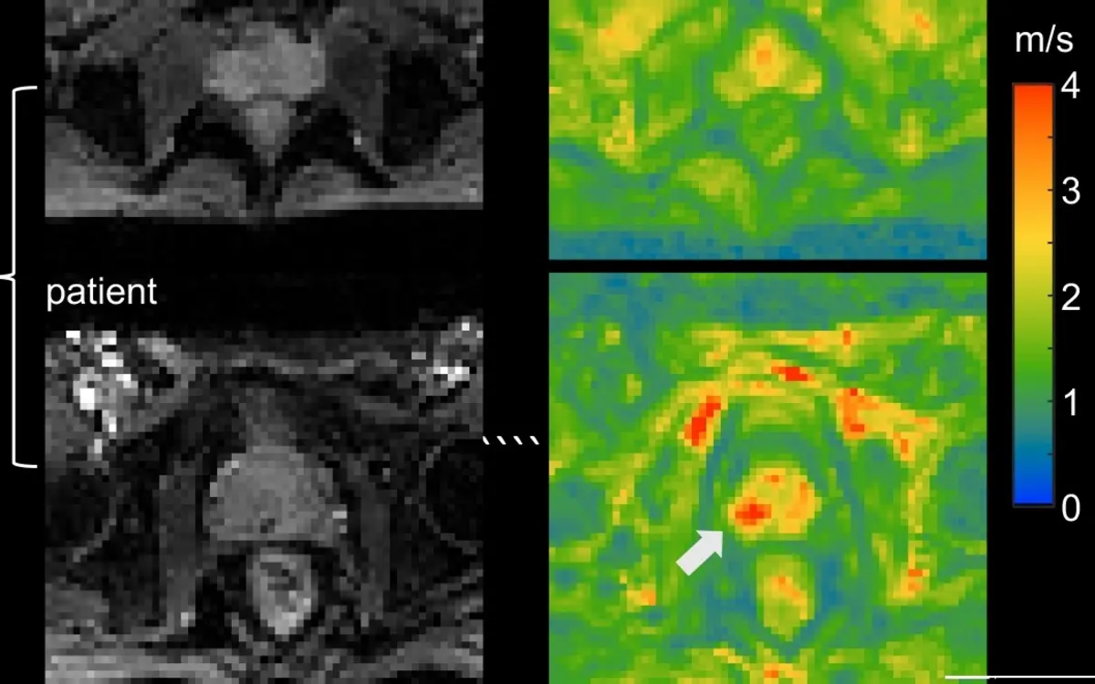Prostate MRI Second Opinion