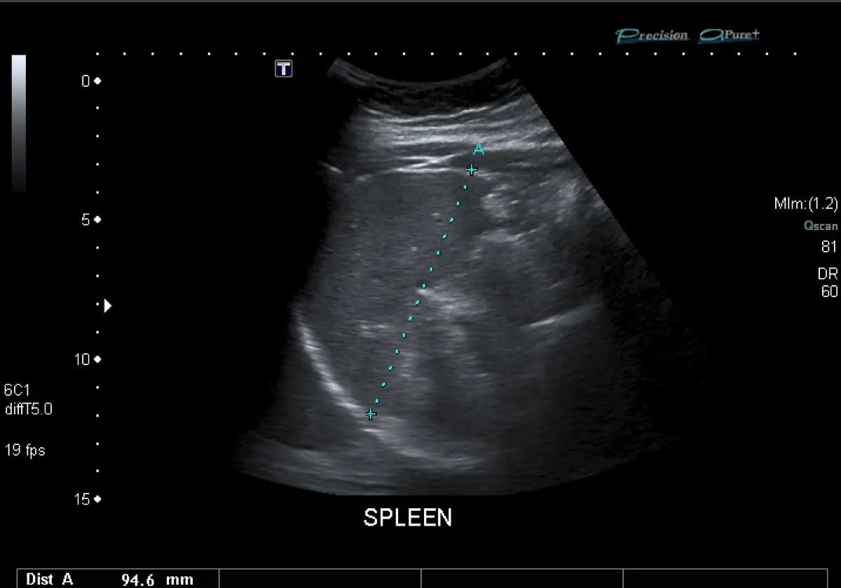 Splenic Mass or Nodule in Dogs: What an Ultrasound Finding Really Means