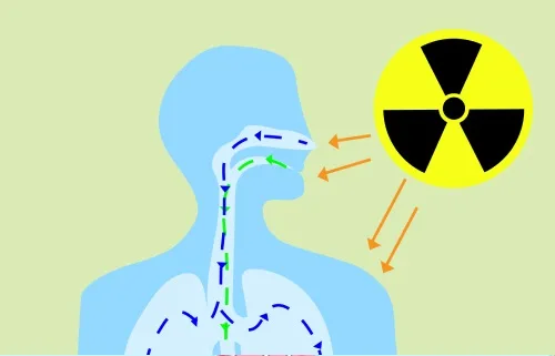 Understanding Radiation Dose in Radiology Scans: A Comprehensive Guide