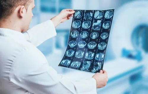 When Should You Get a Second Radiological Opinion?